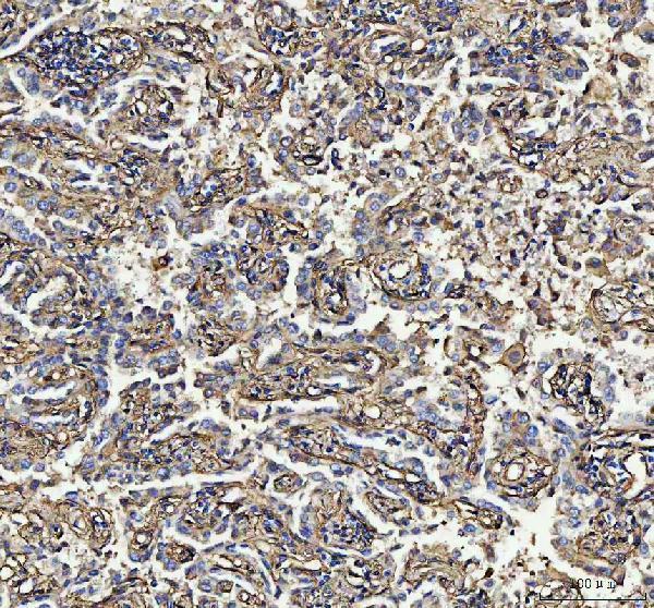 a02787 2 s100a10 primary antibodies ihc testing 5