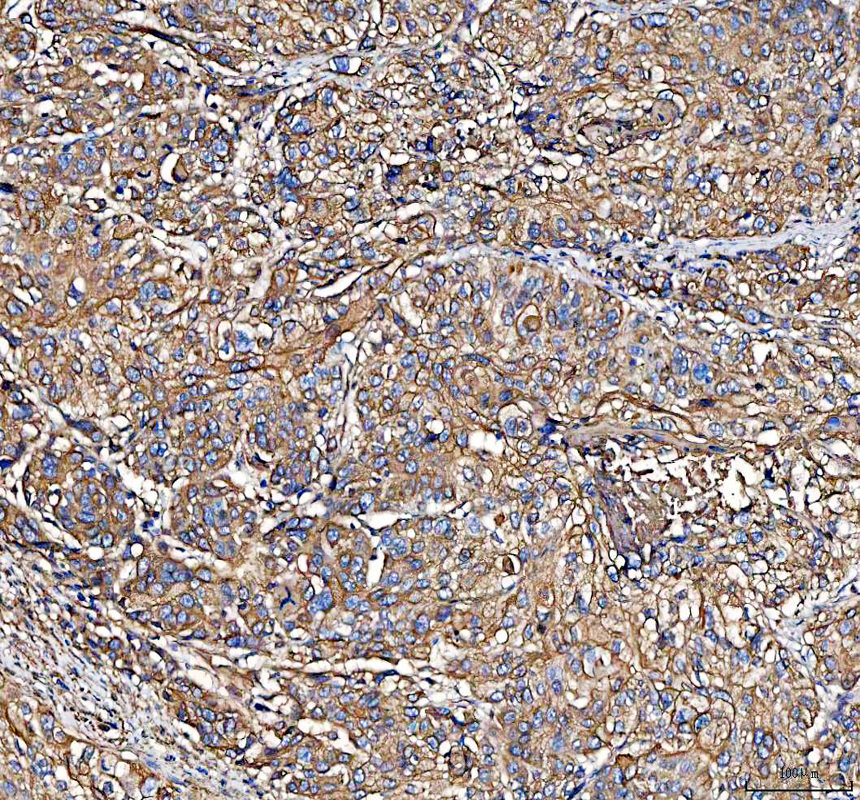 a02787 2 s100a10 primary antibodies ihc testing 5_1