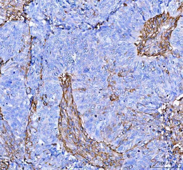 a02787 2 s100a10 primary antibodies ihc testing 6