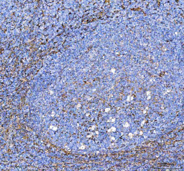a02787 2 s100a10 primary antibodies ihc testing 7