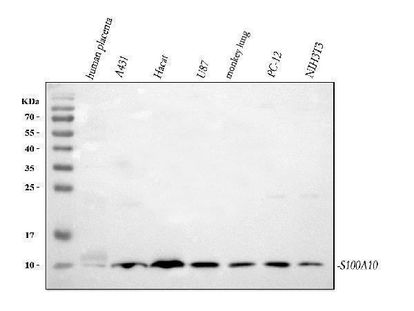  Western blot analysis of S100A10 using anti-S100A10 antibody (A02787-2)