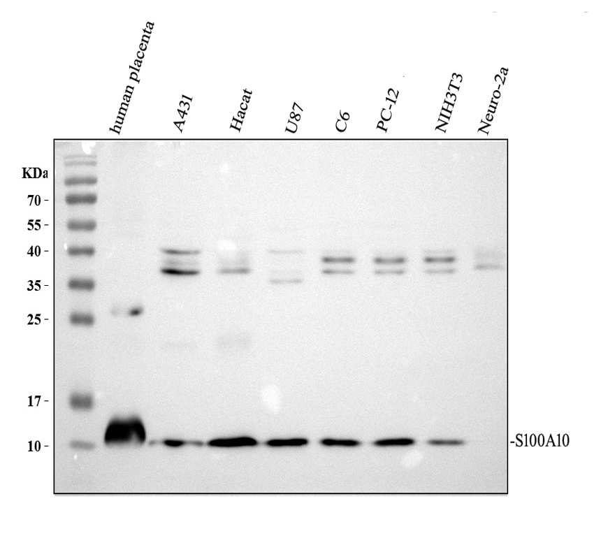 Western blot analysis of S100A10 using anti-S100A10 antibody (A02787-2)