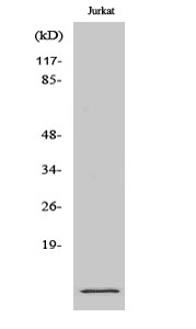 Western Blot (WB) analysis of specific cells using S-100A10 Polyclonal antibody