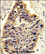 a02791 1 anti pa2g4 antibody center r243 ihc p testing 3