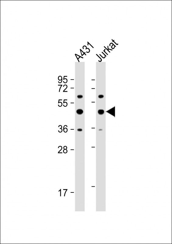 a02791 1 anti pa2g4 antibody center r243 wb testing 2