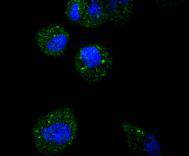a02792 atf5 primary antiboties icc testing 2