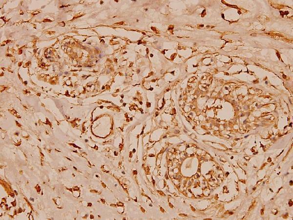 a02794 cstb primary antiboties ihc testing 2