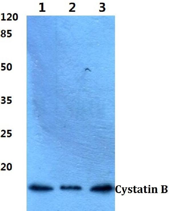 a02794 cstb primary antiboties wb testing 1