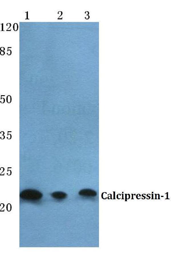 Western blot (WB) analysis of Calcipressin-1 polyclonal antibody at 1:500 dilution
Lane1:Hela cell lysate
Lane2:Raw264