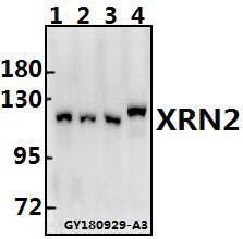 Western blot (WB) analysis of XRN2 polyclonal antibody at 1:500 dilution
Lane1:PC3 whole cell lysate(20ug)
Lane2:A2780 whole cell lysate(20ug)
Lane3:SK-OVCAR3 whole cell lysate(40ug)
Lane4:CT26 whole cell lysate(40ug)