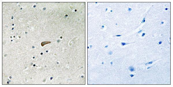 a02798y436 frs2 primary antibodies ihc testing 1
