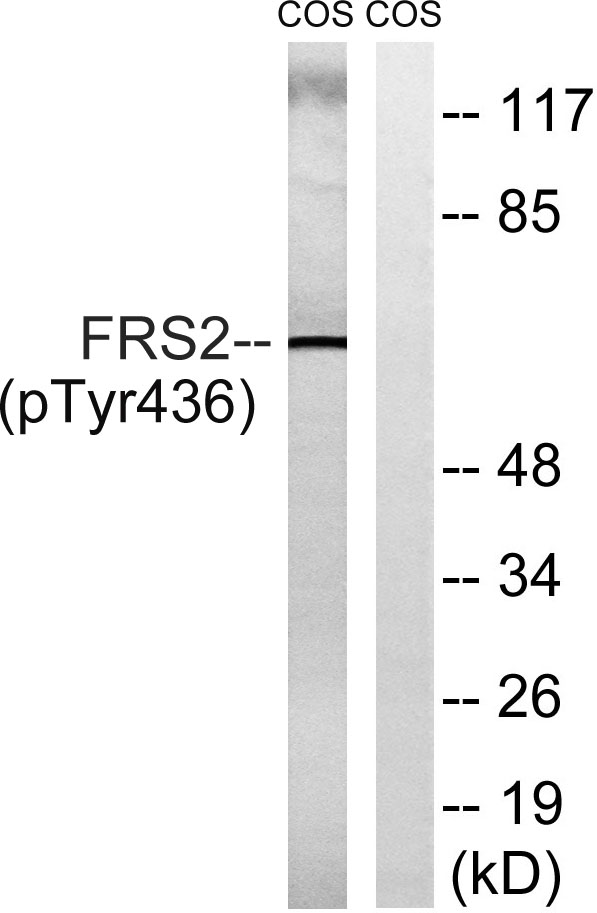 Western blot analysis of lysates from COS7 cells , using FRS2 (Phospho-Tyr436) Antibody