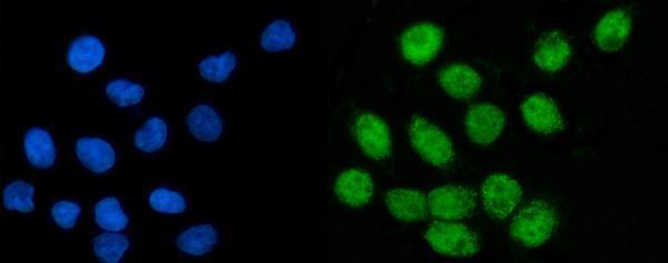  IF analysis of CoREST/RCOR1 using anti-CoREST/RCOR1 antibody (A02799-3)