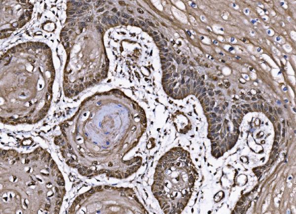  IHC analysis of CoREST/RCOR1 using anti-CoREST/RCOR1 antibody (A02799-3)