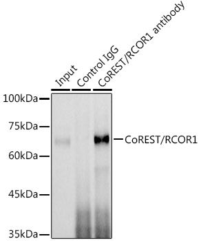 a02799 rcor1 primary antiboties ip testing 2