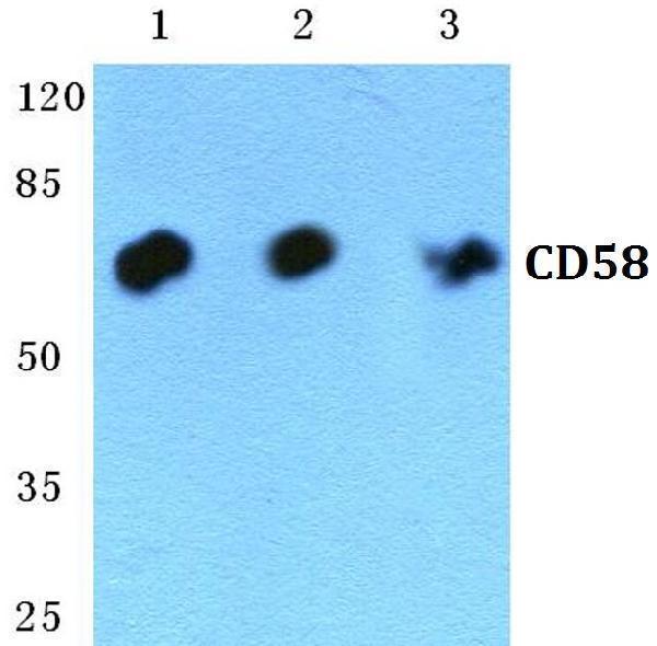 Western blot (WB) analysis of CD58 polyclonal antibody at 1:500 dilution
Lane1:HEK293T cell lysate
Lane2:Raw264