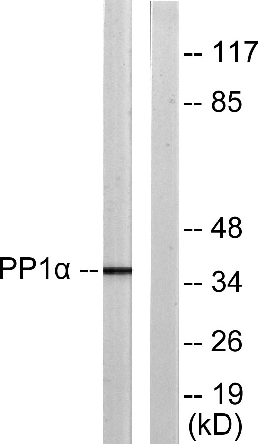 Western blot analysis of PP1-alpha (Phospho-Thr320) Antibody