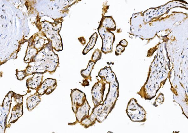 a02802 1 adamts5 primary antibodies ihc testing 2