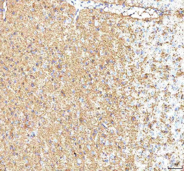  IHC analysis of Hcn2 using anti-Hcn2 antibody (A02804-1)