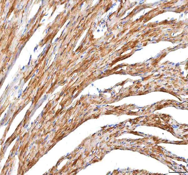 IHC analysis of Hcn2 using anti-Hcn2 antibody (A02804-1)