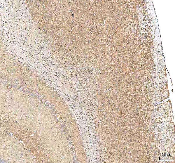a02804 1 hcn2 primary antibodies ihc testing 5