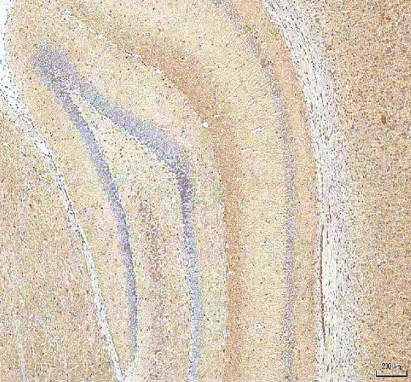 a02804 1 hcn2 primary antibodies ihc testing 7