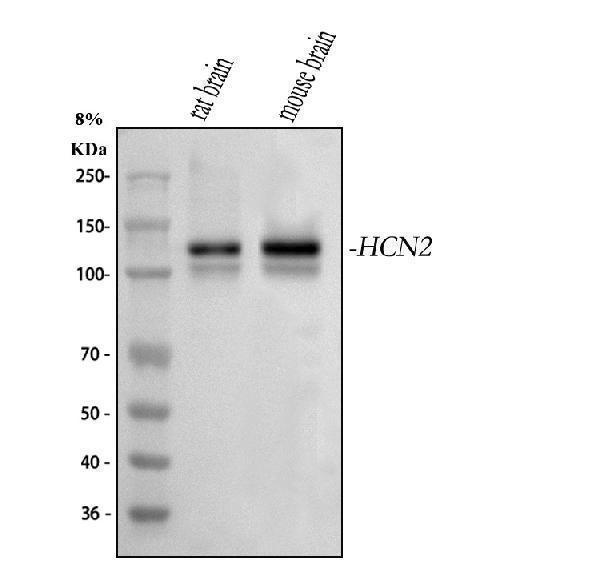  Western blot analysis of Hcn2 using anti-Hcn2 antibody (A02804-1)