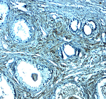 Immunohistochemistry of SPIB in human prostate tissue with SPIB antibody at 2