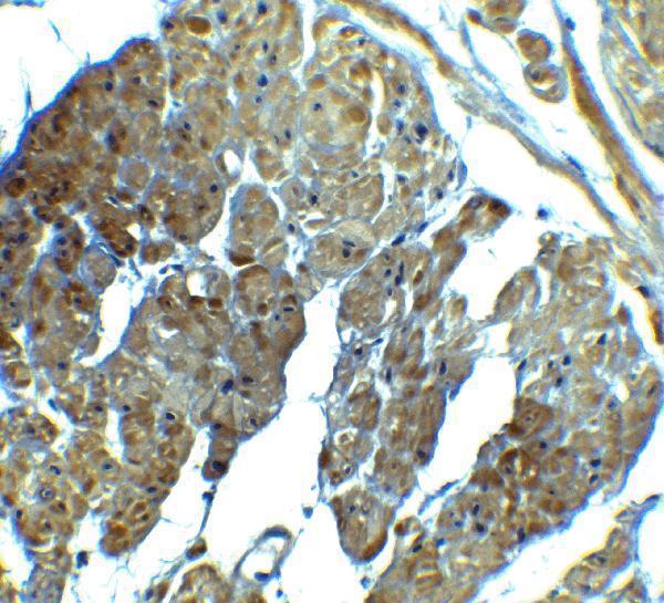 Immunohistochemistry of SPIB in human prostate tissue with SPIB antibody at 2