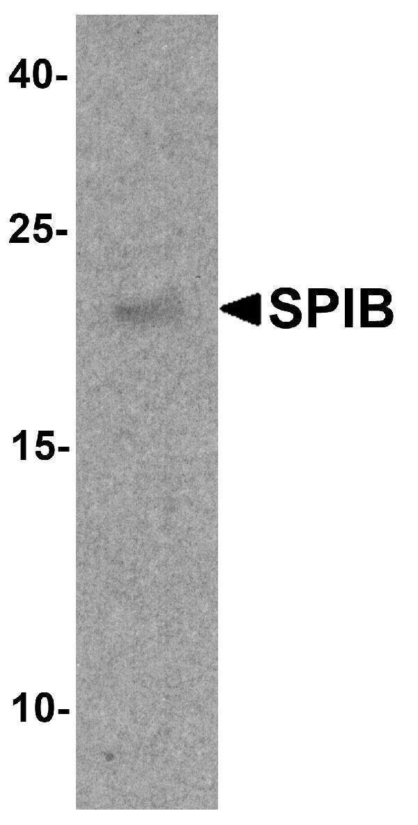 Western blot analysis of SPIB in human prostate tissue lysate with SPIB antibody at 1 μg/ml