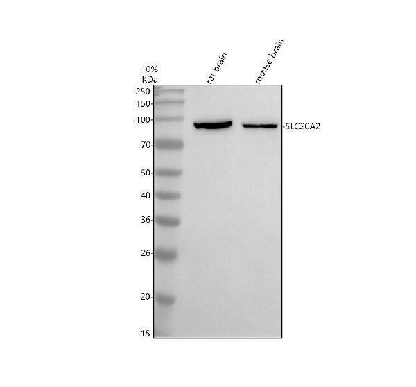 Western blot analysis of SLC20A2 using anti-SLC20A2 antibody (A02806-1)