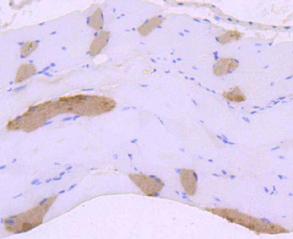 a02808 1 myh6 primary antiboties ihc testing 2