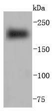 a02808 1 myh6 primary antiboties wb testing 1