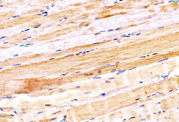  IHC analysis of MYH6 using anti-MYH6 antibody (A02808-2)