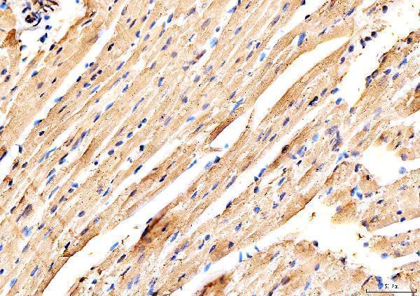  IHC analysis of MYH6 using anti-MYH6 antibody (A02808-2)