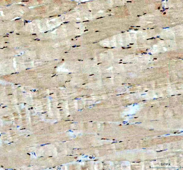 a02809 1 acss2 primary antibodies ihc testing 1