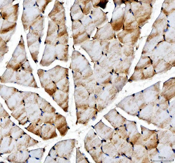 a02809 1 acss2 primary antibodies ihc testing 2