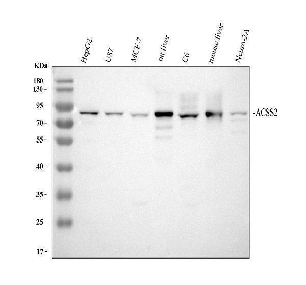 a02809 1 acss2 primary antibodies wb testing 1_1