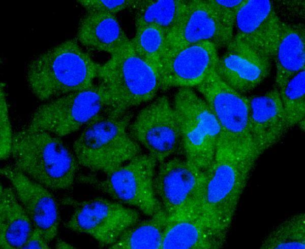 ICC staining Acetyl CoA synthetase in RH-35 cells (green)