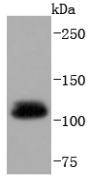 a02810 1 uba1 primary antiboties wb testing 1