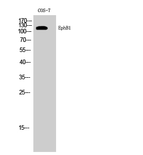 a02811 1 ephb1 primary antibodyes wb testing 1