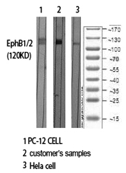 a02811 2 ephb1 primary antibodyes wb testing 1