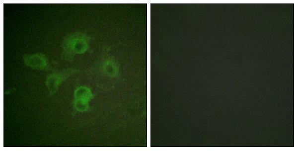 a02811y594 1 ephb1 primary antibodies if testing 1