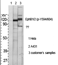a02811y594 1 ephb1 primary antibodies wb testing 2