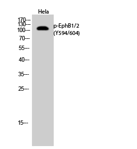 a02811y594 1 ephb1 primary antibodies wb testing 3