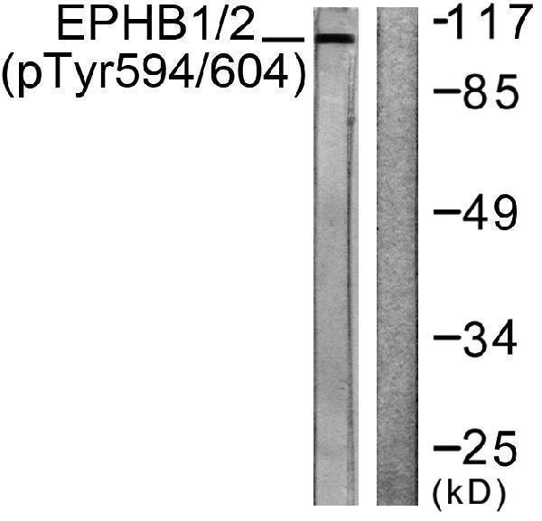 a02811y594 1 ephb1 primary antibodies wb testing 4