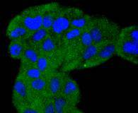 ICC staining ERK5 in Hela cells (green)