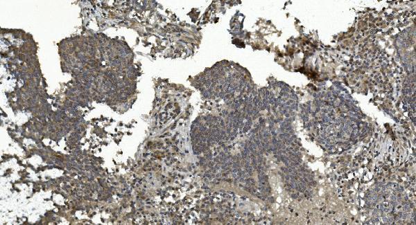a02812 3 mapk7 primary antibodies ihc testing 3