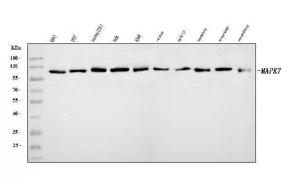 Western blot analysis of ERK5/MAPK7 using anti-ERK5/MAPK7 antibody (A02812-4)