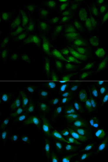 Immunofluorescence analysis of MCF-7 cells using ERK5 antibody 